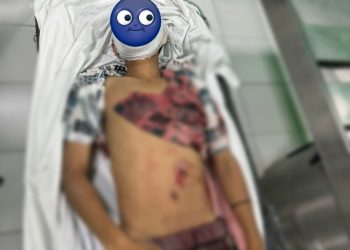 Ketahuan Mencuri Remaja Tewas Ditikam