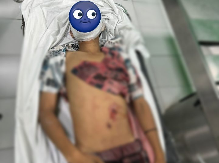 Ketahuan Mencuri Remaja Tewas Ditikam